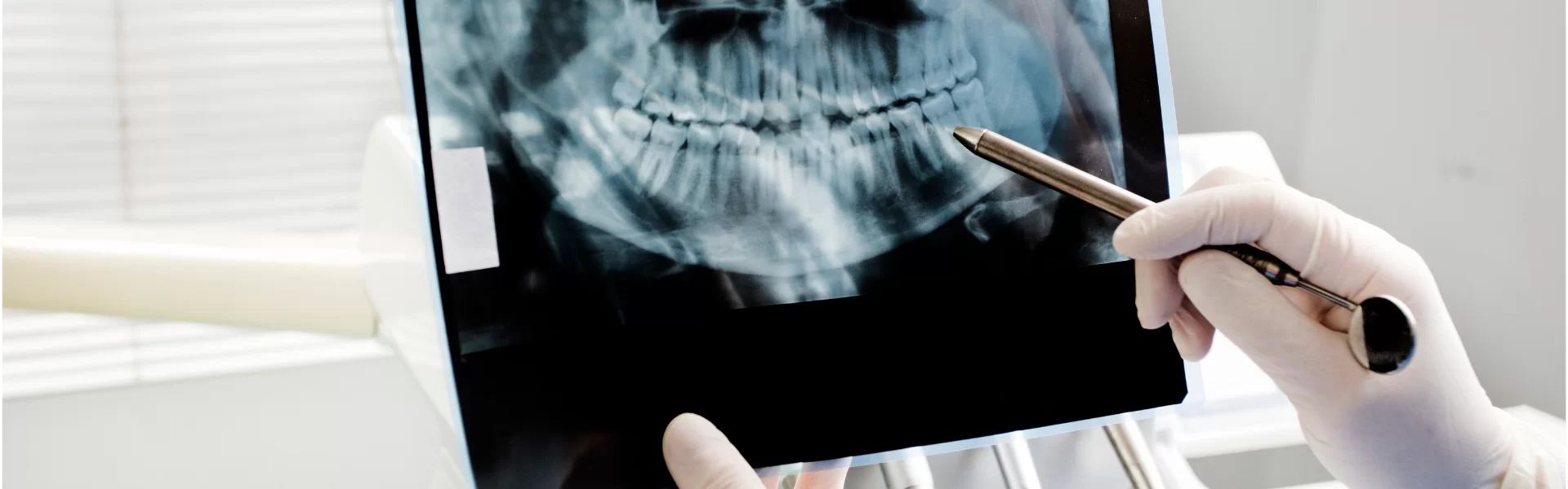 İmplant tedavisi, estetik diş hekimliği, ortodonti, çocuk diş sağlığı, diş beyazlatma ve daha fazlası… Ağız ve diş sağlığınız için ihtiyaç duyduğunuz tüm hizmetleri uzman diş hekimlerimizle tek çatı altında sunuyoruz. 